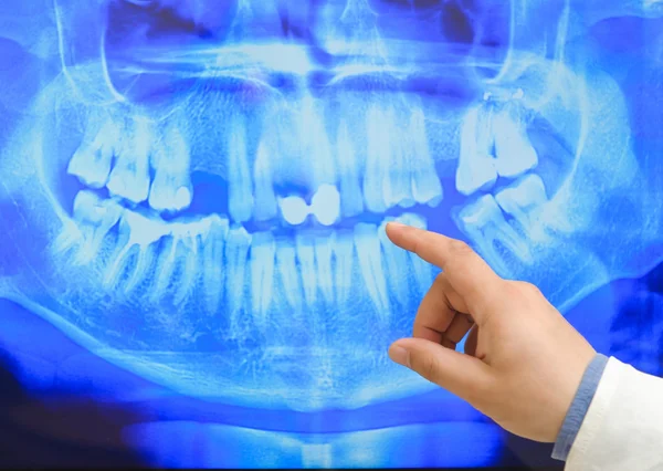 엑스레이를 보고 있는 남성 의사나 치과 의사의 사진. — 스톡 사진