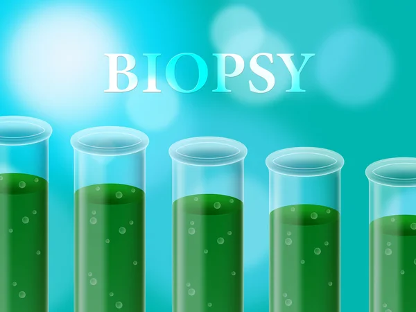 Biopsie Test znamená prozkoumány laboratorní a analyzovat — Stock fotografie