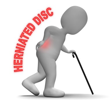 Vertebral sütun ve sırt ağrısı fıtığı gösterir 3d Render