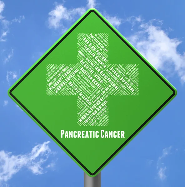 Pancreatic Cancer Shows Malignant Growth And Adenocarcinoma — Stock Photo, Image