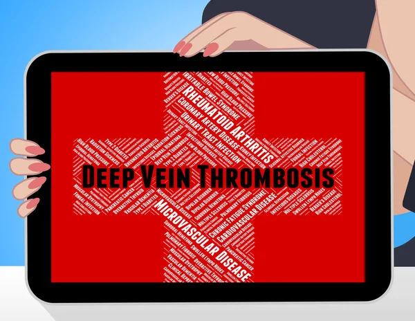 La thrombose veineuse profonde représente une maladie et une plainte — Photo