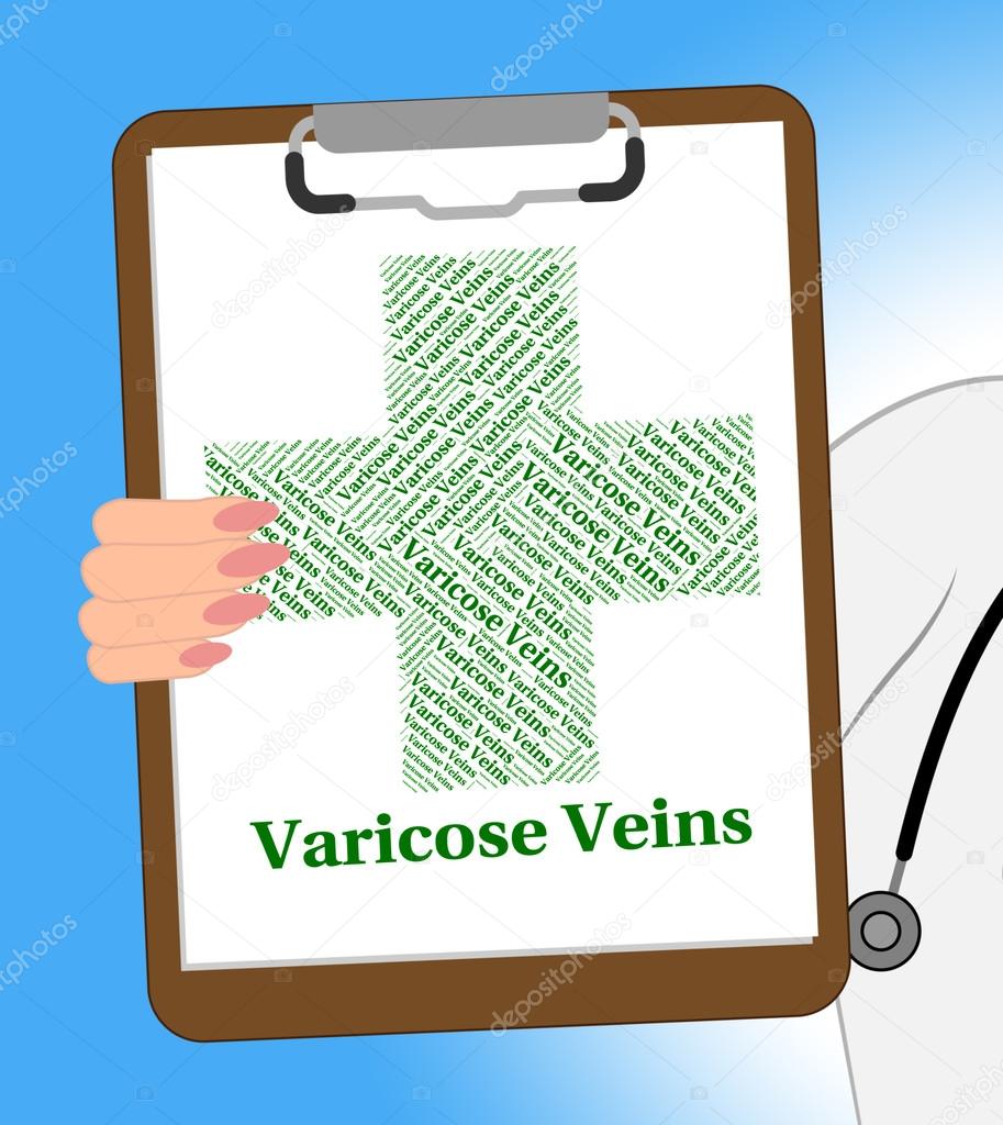 Varicose Veins Shows Circulatory System And Ailments
