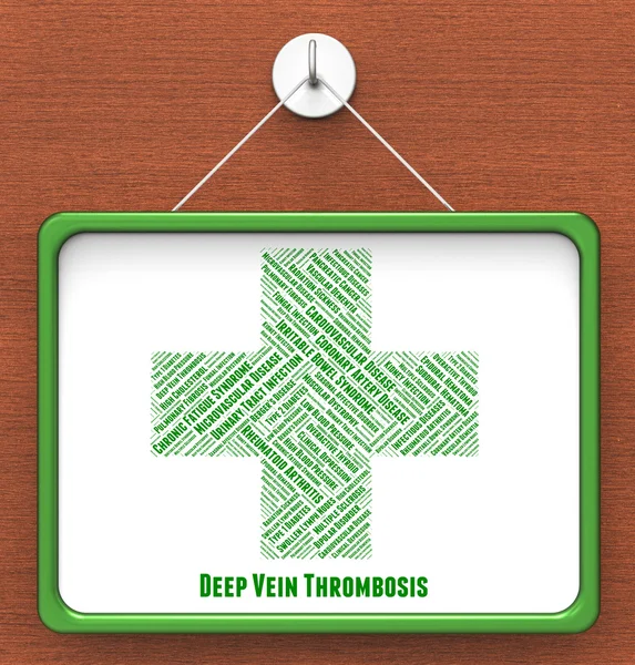 Deep Vein Thrombosis Indicates Ill Health And Circulatory — Stock Photo, Image