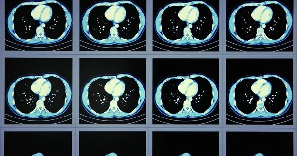 Many Computed Tomography Scans Motion Lower Middle Abdominal Body Area — Stock Photo, Image