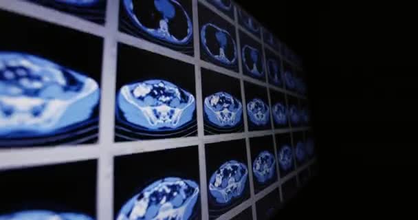 Mnoho počítačové tomografie skenuje v pohybu dolní a střední břišní oblasti — Stock video