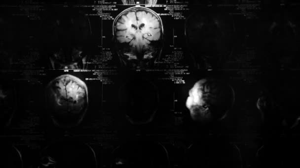 Resplandor y resonancia magnética radiante — Vídeo de stock