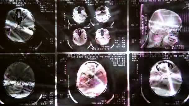 Svítící a zářící Mri skenování — Stock video