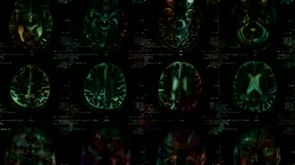 Closeup Ct Scan — Stock video