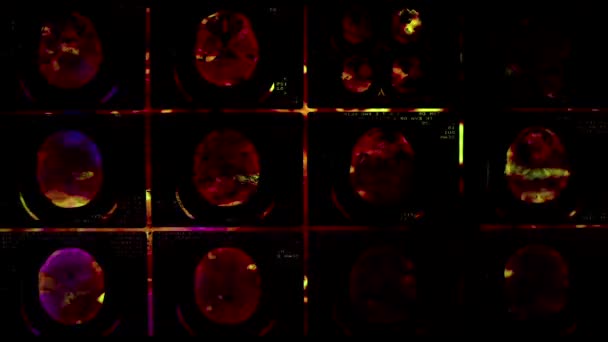 Close-up van een Ct-scan — Stockvideo