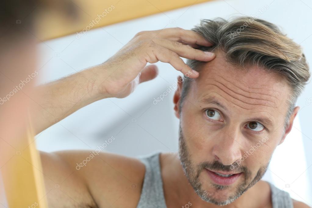 man concerned by hair loss