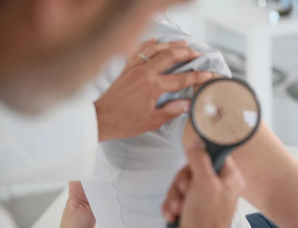 Dermatologist looking at woman's mole — Stock Photo, Image