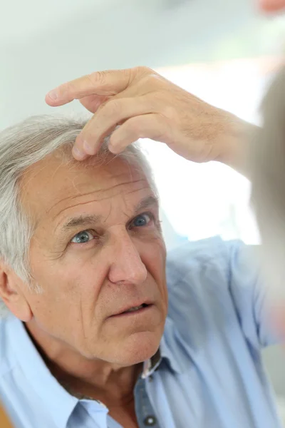 Homem preocupado com a perda de cabelo — Fotografia de Stock