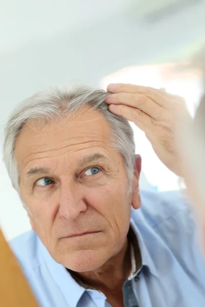 Человек обеспокоен выпадением волос — стоковое фото