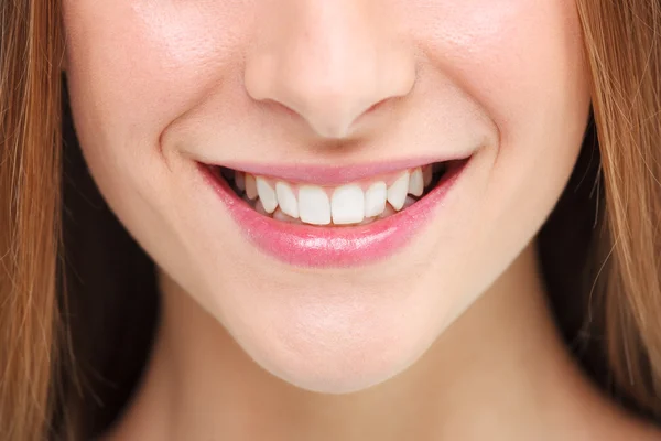 Kvinnan leende. Tandblekning koncept. — Stockfoto