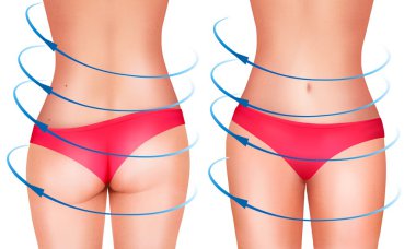 Kadın vücudunda cerrahi gösteren satırlar. Vektör.