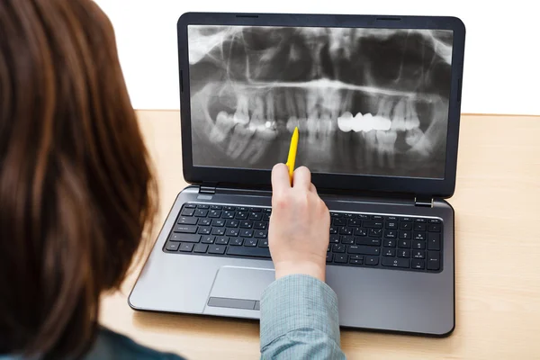 Student analysiert Röntgenbild von Kiefer auf Laptop — Stockfoto