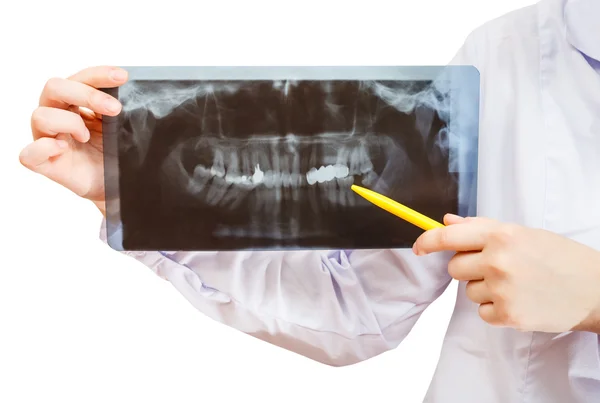 Enfermera sostiene imagen de rayos X con mandíbula humana — Foto de Stock