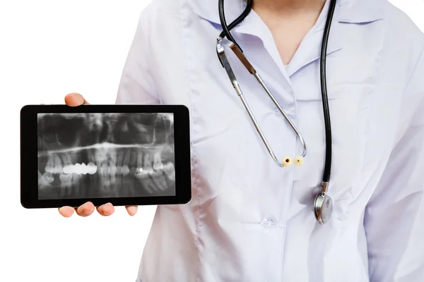 Enfermera sostiene la tableta PC con imagen de rayos X de las mandíbulas —  Fotos de Stock