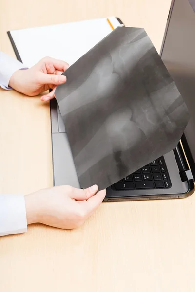 Doctor examines X-ray picture of knee joint — Stock Photo, Image