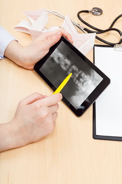 Doctor examines X-ray picture of spinal column — Stock Photo, Image