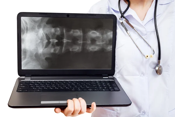 Nurse holds computer laptop with spinal column — Stock Photo, Image