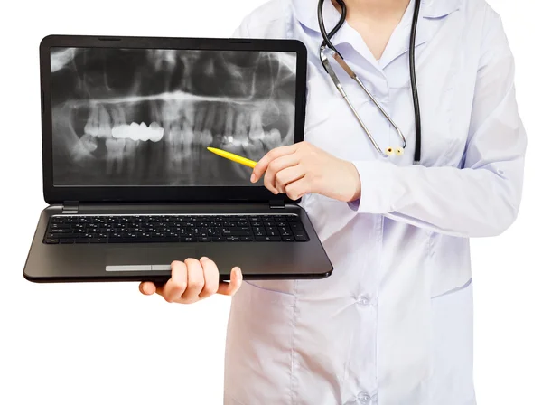 Nurse points on computer laptop with human jaw — Stock Photo, Image