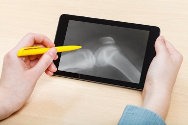 student analyzes human knee-joint on tablet pc clipart
