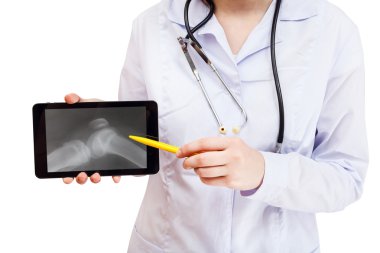 Hemşire Puan insan diz eklem ile tablet PC