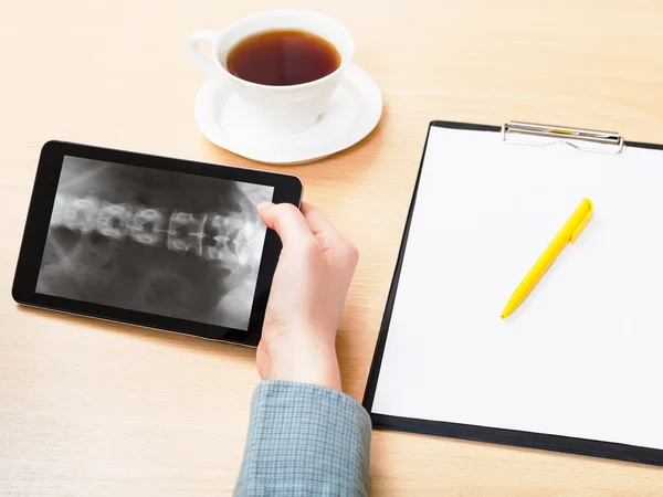 Medic analyzes vertebral column on tablet pc — Stock Photo, Image