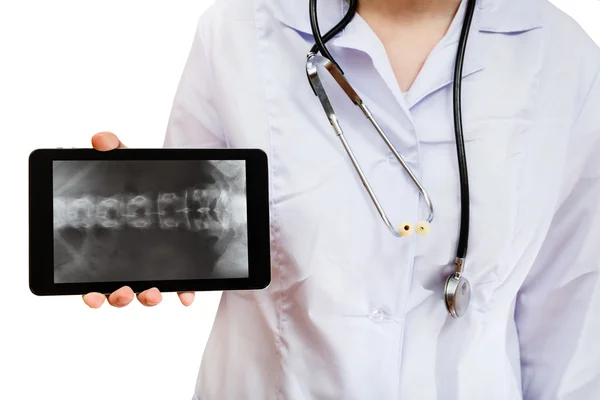 Nurse holds tablet pc with human spinal column — Stock Photo, Image