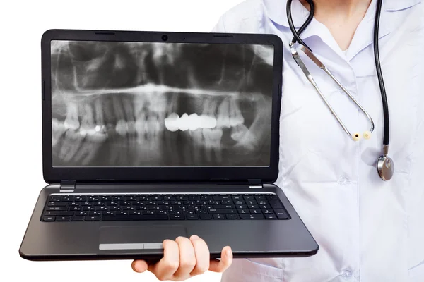 Nurse holds computer laptop with human jaw — Stock Photo, Image