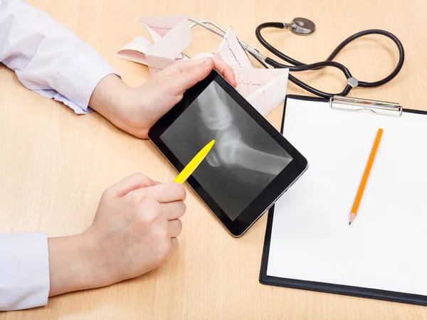 Doctor examines X-ray picture of human knee joint — Stock Photo, Image