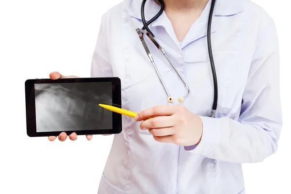 Krankenschwester zeigt auf Tablet-PC mit Wirbelsäule — Stockfoto