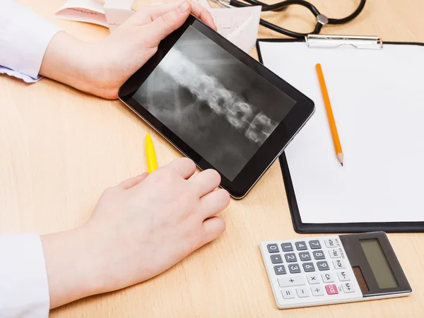 Medic look on X-ray picture of vertebral colum — Stock Photo, Image