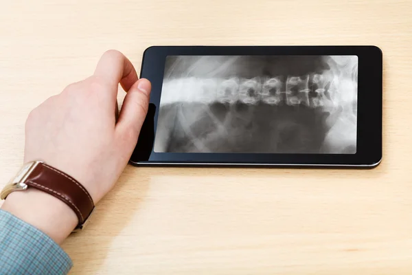 Scientist analyzes vertebral column on tablet pc — Stock Photo, Image