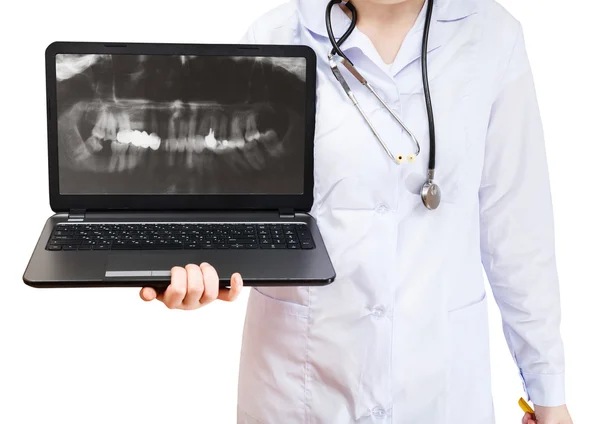 Krankenschwester hält Computer-Laptop mit menschlichen Zähnen — Stockfoto