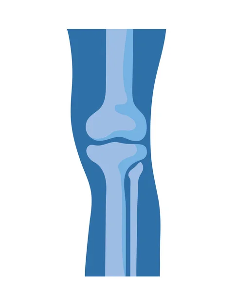 Huesos normales de rodilla — Vector de stock
