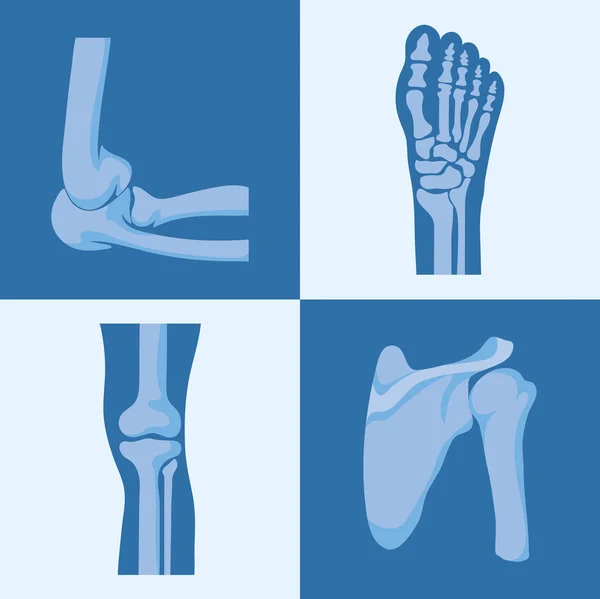 Four rheumatology joints — Stock Vector