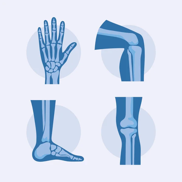 Reumatologie botten pictogrammen — Stockvector