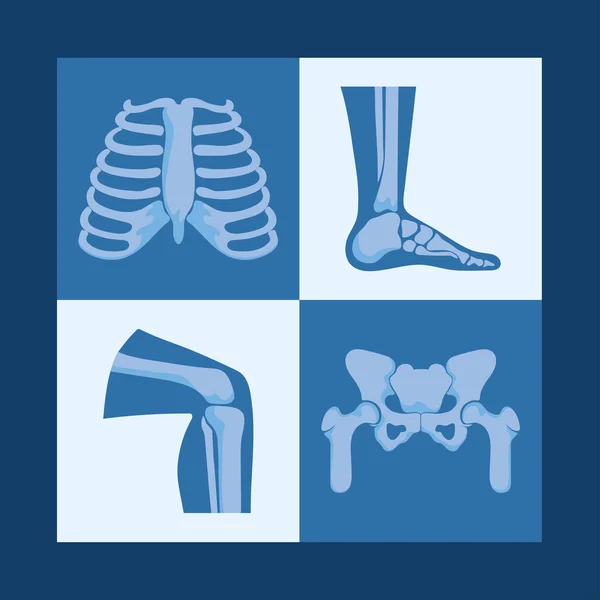 Diseños de huesos reumatológicos — Vector de stock
