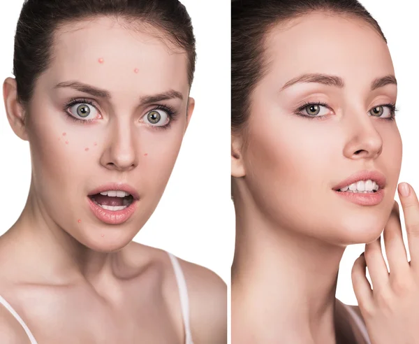 Mujer con problemas de piel en la cara —  Fotos de Stock