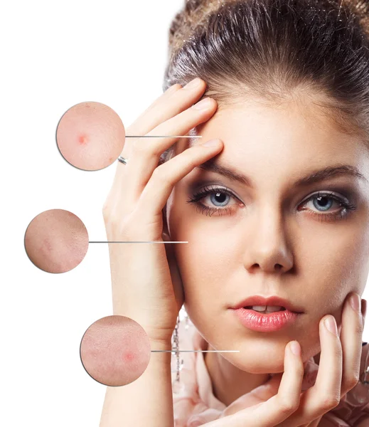 Portrait of young woman with magnifier circles — Stock Photo, Image