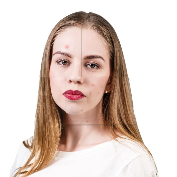 Рамки с проблемной кожей на лице женщины — стоковое фото