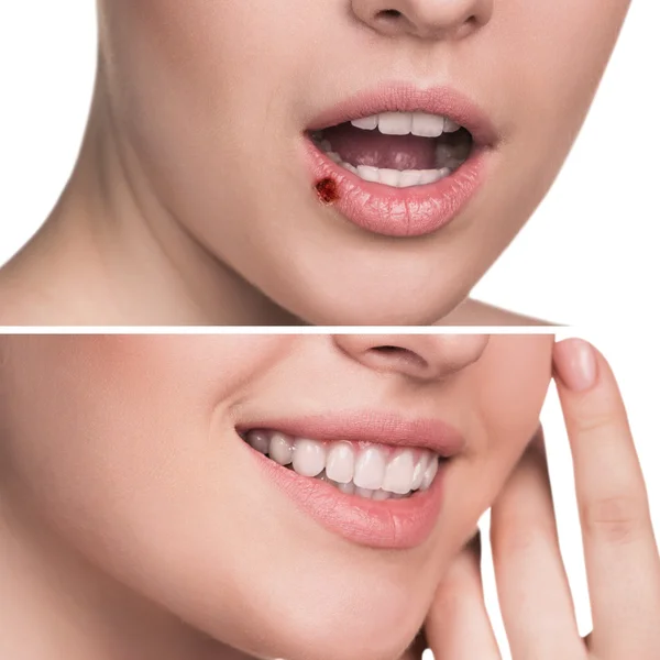 Dor nos lábios femininos — Fotografia de Stock