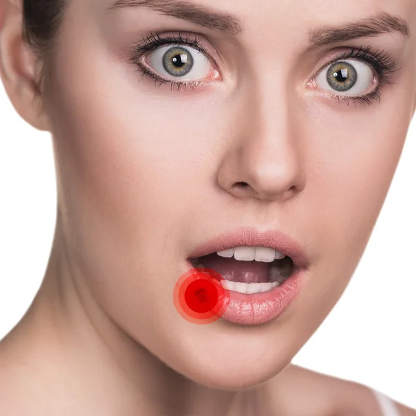 Dolor en los labios femeninos — Foto de Stock