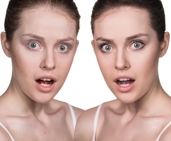 Young woman without and with makeup — Stock Photo, Image