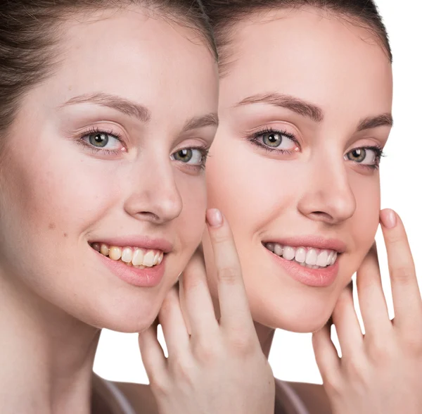 Young woman without and with makeup — Stock Photo, Image