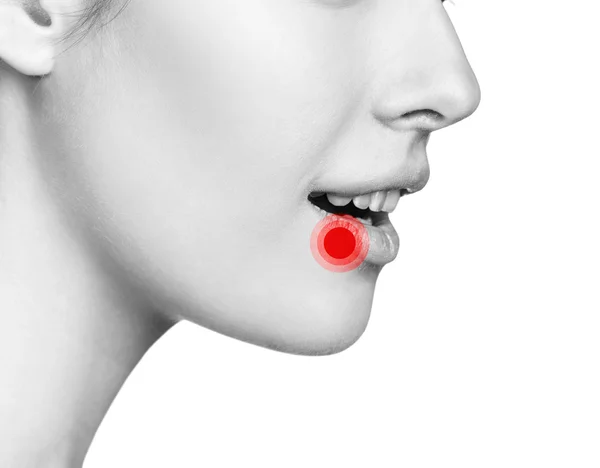 Wunde an den weiblichen Lippen — Stockfoto