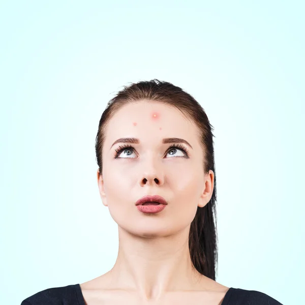 Chica confundida con acné en la frente — Foto de Stock