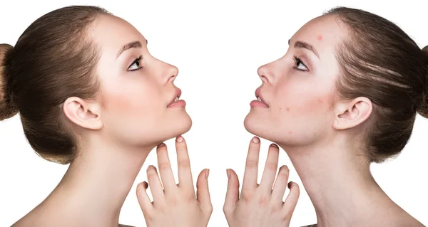 Sorunlu cilt portresi karşılaştırma